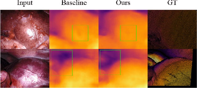 Figure 1 for EndoDepthL: Lightweight Endoscopic Monocular Depth Estimation with CNN-Transformer