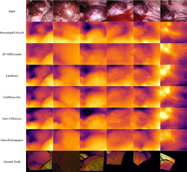 Figure 4 for EndoDepthL: Lightweight Endoscopic Monocular Depth Estimation with CNN-Transformer