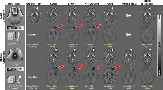 Figure 4 for Plug-and-Play Latent Feature Editing for Orientation-Adaptive Quantitative Susceptibility Mapping Neural Networks