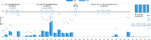 Figure 4 for APIS: A paired CT-MRI dataset for ischemic stroke segmentation challenge