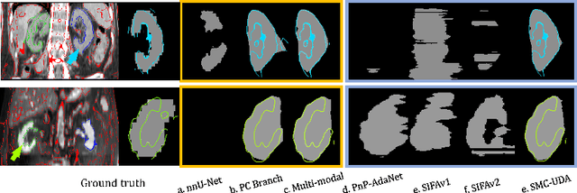 Figure 4 for SMC-UDA: Structure-Modal Constraint for Unsupervised Cross-Domain Renal Segmentation