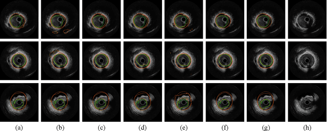 Figure 3 for CSDN: Combing Shallow and Deep Networks for Accurate Real-time Segmentation of High-definition Intravascular Ultrasound Images