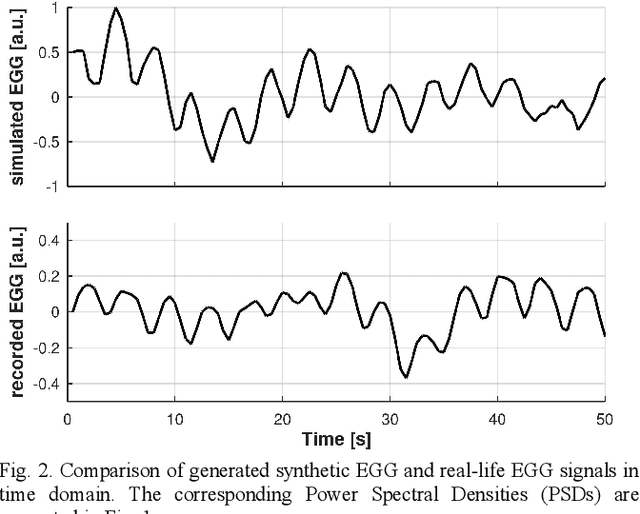 Figure 2 for Data-driven Method for Generating Synthetic Electrogastrogram Time Series