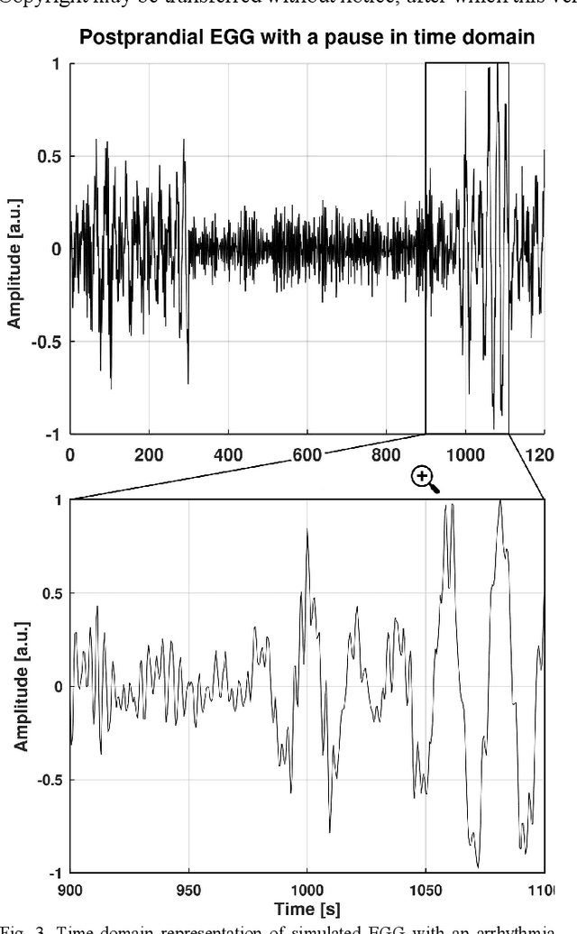 Figure 3 for Data-driven Method for Generating Synthetic Electrogastrogram Time Series