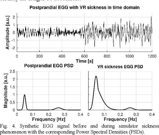Figure 4 for Data-driven Method for Generating Synthetic Electrogastrogram Time Series