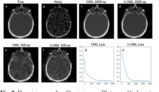 Figure 2 for Equivariant Spherical CNN for Data Efficient and High-Performance Medical Image Processing