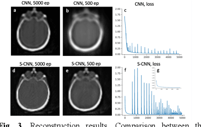 Figure 3 for Equivariant Spherical CNN for Data Efficient and High-Performance Medical Image Processing