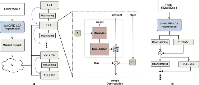 Figure 1 for Brain Tumor Synthetic Data Generation with Adaptive StyleGANs