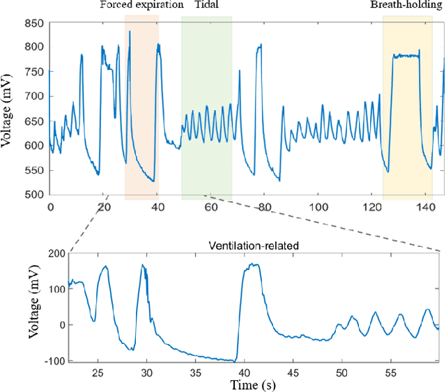 Figure 3 for Spatio-Temporal Classification of Lung Ventilation Patterns using 3D EIT Images: A General Approach for Individualized Lung Function Evaluation