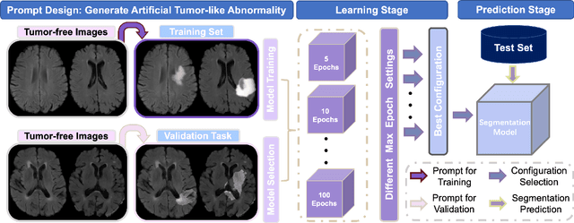Figure 1 for Unsupervised Brain Tumor Segmentation with Image-based Prompts