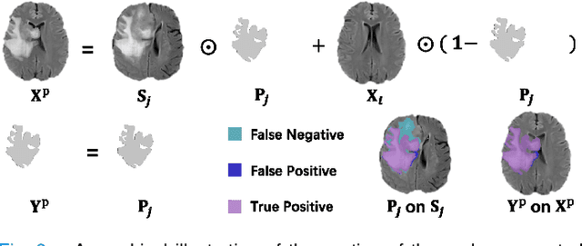 Figure 3 for Unsupervised Brain Tumor Segmentation with Image-based Prompts