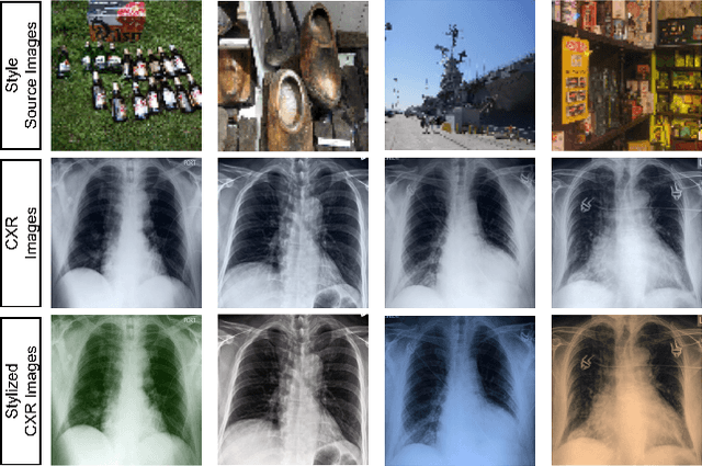 Figure 3 for Learning to Generalize towards Unseen Domains via a Content-Aware Style Invariant Framework for Disease Detection from Chest X-rays
