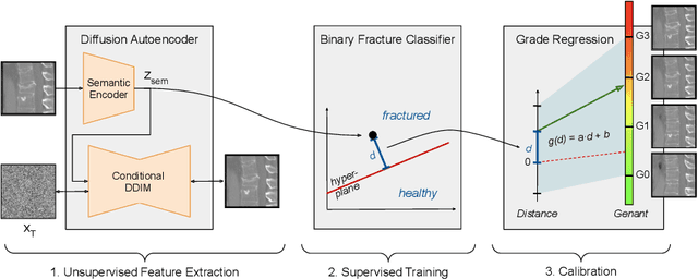 Figure 1 for Semantic Latent Space Regression of Diffusion Autoencoders for Vertebral Fracture Grading