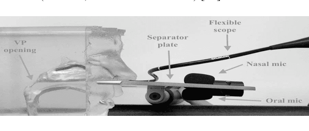 Figure 2 for Speaker-independent Speech Inversion for Estimation of Nasalance