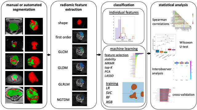 Figure 4 for Developing a Machine Learning-Based Clinical Decision Support Tool for Uterine Tumor Imaging