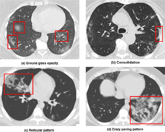 Figure 3 for Deep Learning and Medical Imaging for COVID-19 Diagnosis: A Comprehensive Survey