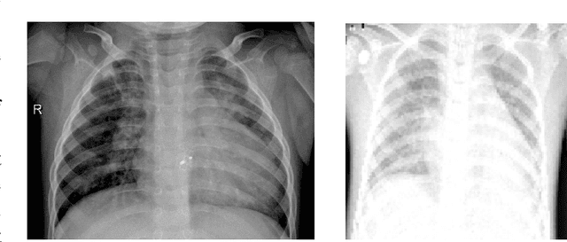 Figure 1 for Advancing Diagnostic Precision: Leveraging Machine Learning Techniques for Accurate Detection of Covid-19, Pneumonia, and Tuberculosis in Chest X-Ray Images