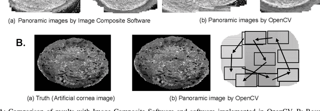 Figure 3 for Generating corneal panoramic images from contact specular microscope images