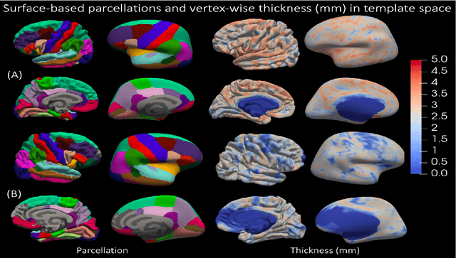 Figure 3 for Surface-based parcellation and vertex-wise analysis of ultra high-resolution ex vivo 7 tesla MRI in neurodegenerative diseases