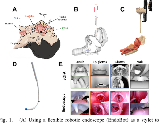 Figure 1 for Sim-to-Real Segmentation in Robot-assisted Transoral Tracheal Intubation