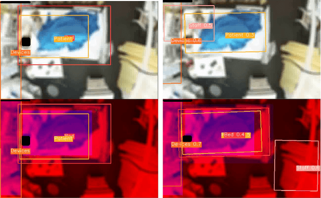 Figure 2 for Video object detection for privacy-preserving patient monitoring in intensive care