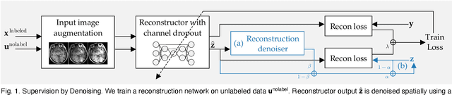 Figure 1 for SUD: Supervision by Denoising for Medical Image Segmentation