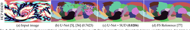 Figure 2 for SUD: Supervision by Denoising for Medical Image Segmentation