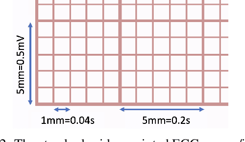 Figure 3 for A Synthetic Electrocardiogram (ECG) Image Generation Toolbox to Facilitate Deep Learning-Based Scanned ECG Digitization