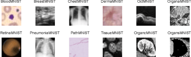 Figure 4 for MLOps for Scarce Image Data: A Use Case in Microscopic Image Analysis