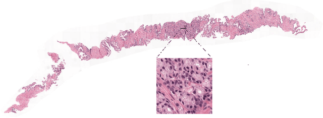Figure 2 for Artifact-Robust Graph-Based Learning in Digital Pathology
