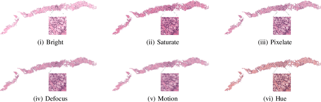Figure 3 for Artifact-Robust Graph-Based Learning in Digital Pathology