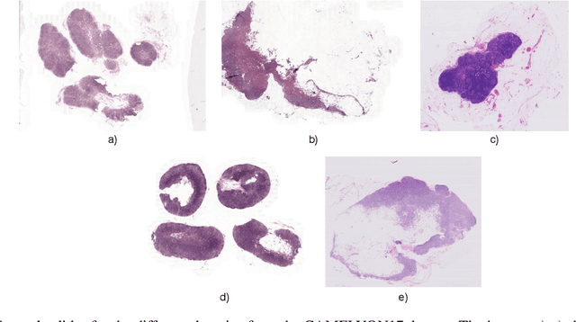 Figure 3 for Multi-domain stain normalization for digital pathology: A cycle-consistent adversarial network for whole slide images