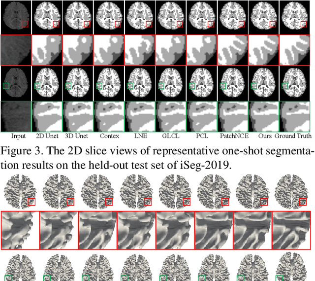 Figure 4 for Dual Meta-Learning with Longitudinally Generalized Regularization for One-Shot Brain Tissue Segmentation Across the Human Lifespan