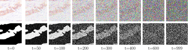 Figure 3 for Analysing Diffusion Segmentation for Medical Images