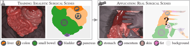 Figure 1 for Semantic segmentation of surgical hyperspectral images under geometric domain shifts