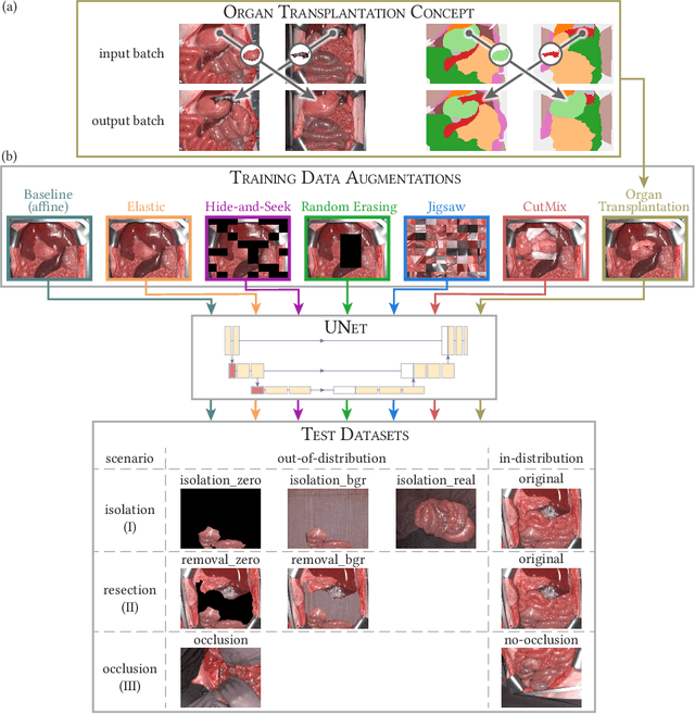 Figure 2 for Semantic segmentation of surgical hyperspectral images under geometric domain shifts