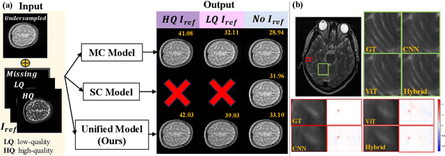 Figure 1 for DuDoUniNeXt: Dual-domain unified hybrid model for single and multi-contrast undersampled MRI reconstruction