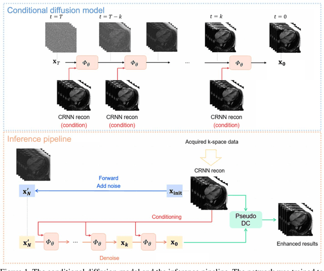 Figure 1 for Clinically Feasible Diffusion Reconstruction for Highly-Accelerated Cardiac Cine MRI