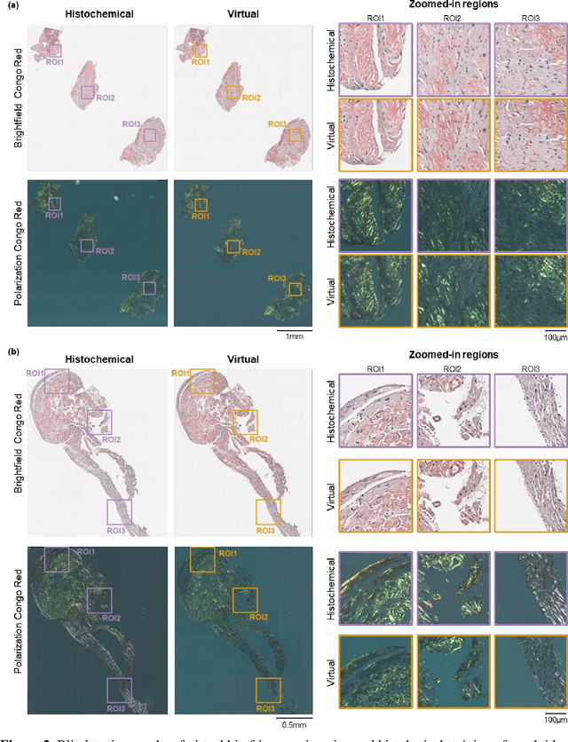 Figure 2 for Virtual birefringence imaging and histological staining of amyloid deposits in label-free tissue using autofluorescence microscopy and deep learning