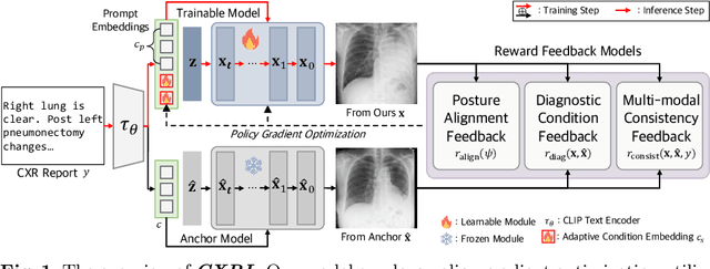 Figure 1 for Advancing Text-Driven Chest X-Ray Generation with Policy-Based Reinforcement Learning