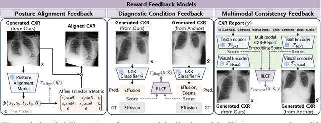 Figure 4 for Advancing Text-Driven Chest X-Ray Generation with Policy-Based Reinforcement Learning