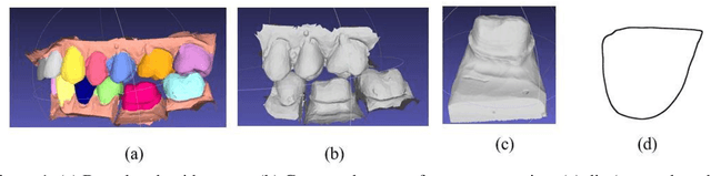 Figure 1 for Improving the quality of dental crown using a Transformer-based method