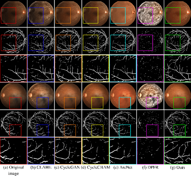 Figure 2 for Retinal Image Restoration using Transformer and Cycle-Consistent Generative Adversarial Network