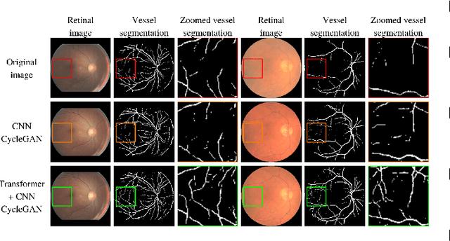 Figure 3 for Retinal Image Restoration using Transformer and Cycle-Consistent Generative Adversarial Network