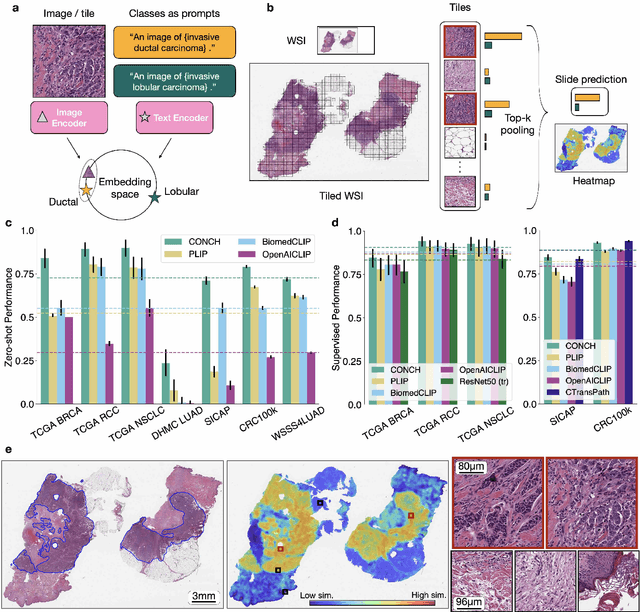 Figure 3 for Towards a Visual-Language Foundation Model for Computational Pathology