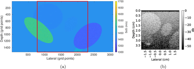 Figure 1 for Deep Learning for Ultrasound Speed-of-Sound Reconstruction: Impacts of Training Data Diversity on Stability and Robustness