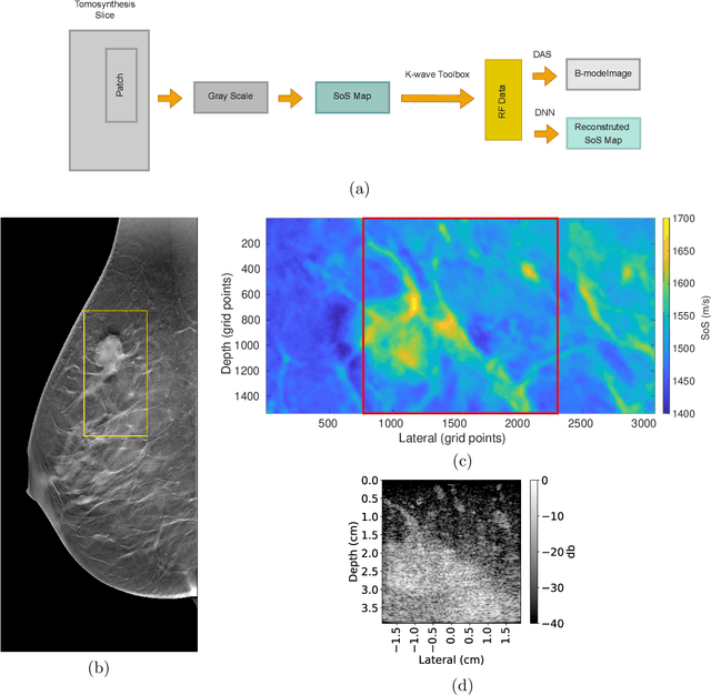 Figure 2 for Deep Learning for Ultrasound Speed-of-Sound Reconstruction: Impacts of Training Data Diversity on Stability and Robustness