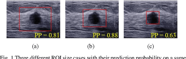 Figure 1 for Weakly Supervised Lesion Detection and Diagnosis for Breast Cancers with Partially Annotated Ultrasound Images