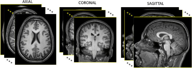 Figure 2 for Automated computed tomography and magnetic resonance imaging segmentation using deep learning: a beginner's guide