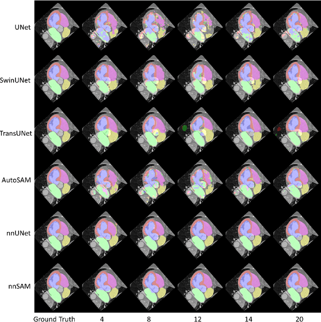 Figure 3 for nnSAM: Plug-and-play Segment Anything Model Improves nnUNet Performance